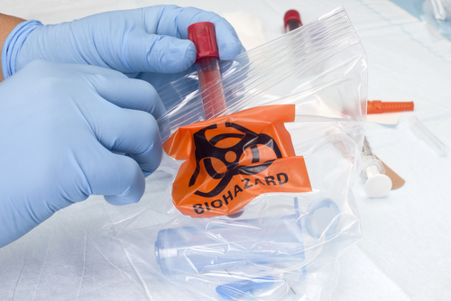 Embalaje de muestras para el transporte: bolsas de espécimen de biohazard